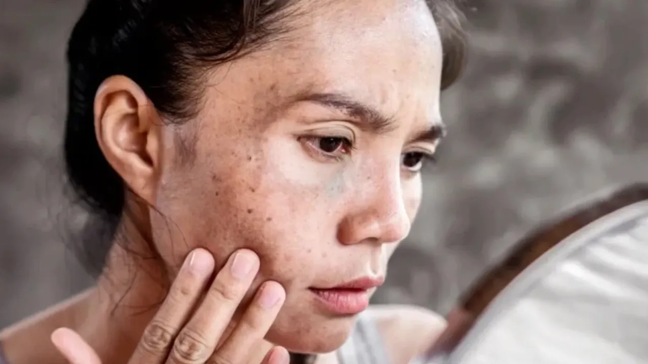 Limitations of natural skincare remedies