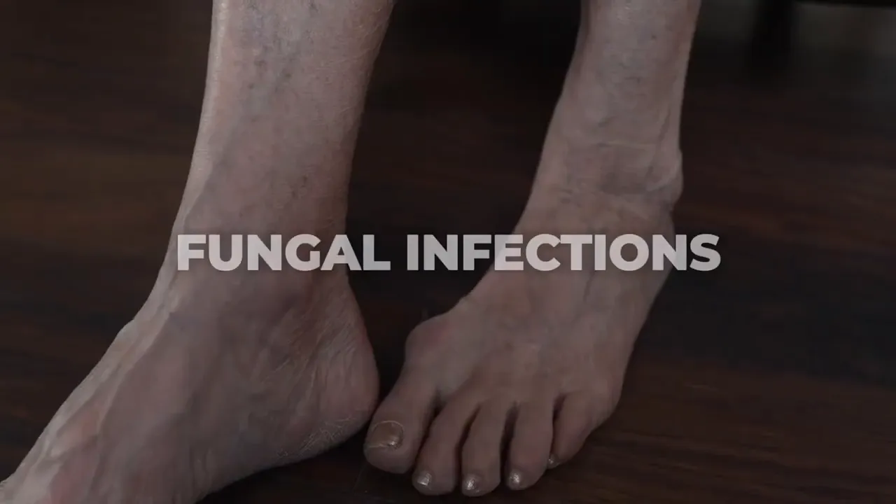 Stem Cell Treatment: The Revolutionary Solution to Toenail Fungus and Cellular Health